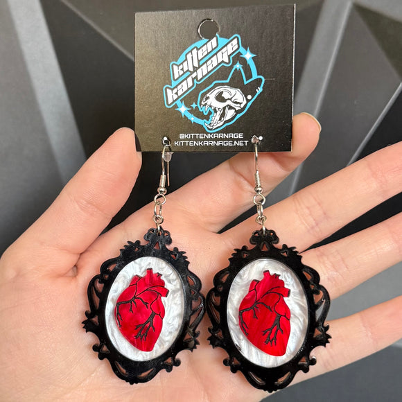 Anatomical Heart in Frame Earrings